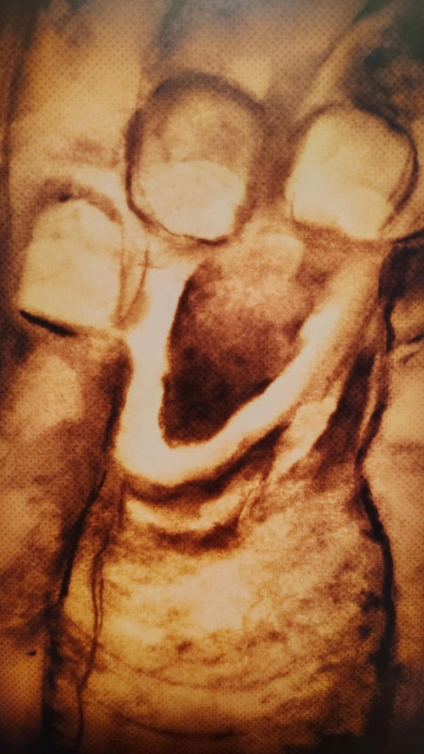 Rumaldo R Medina, Skin, 2022