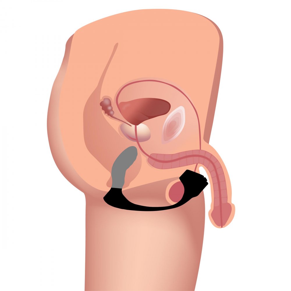 7X Silicone Prostate Plug w- Ball Stretcher & Remote by trinity vibes